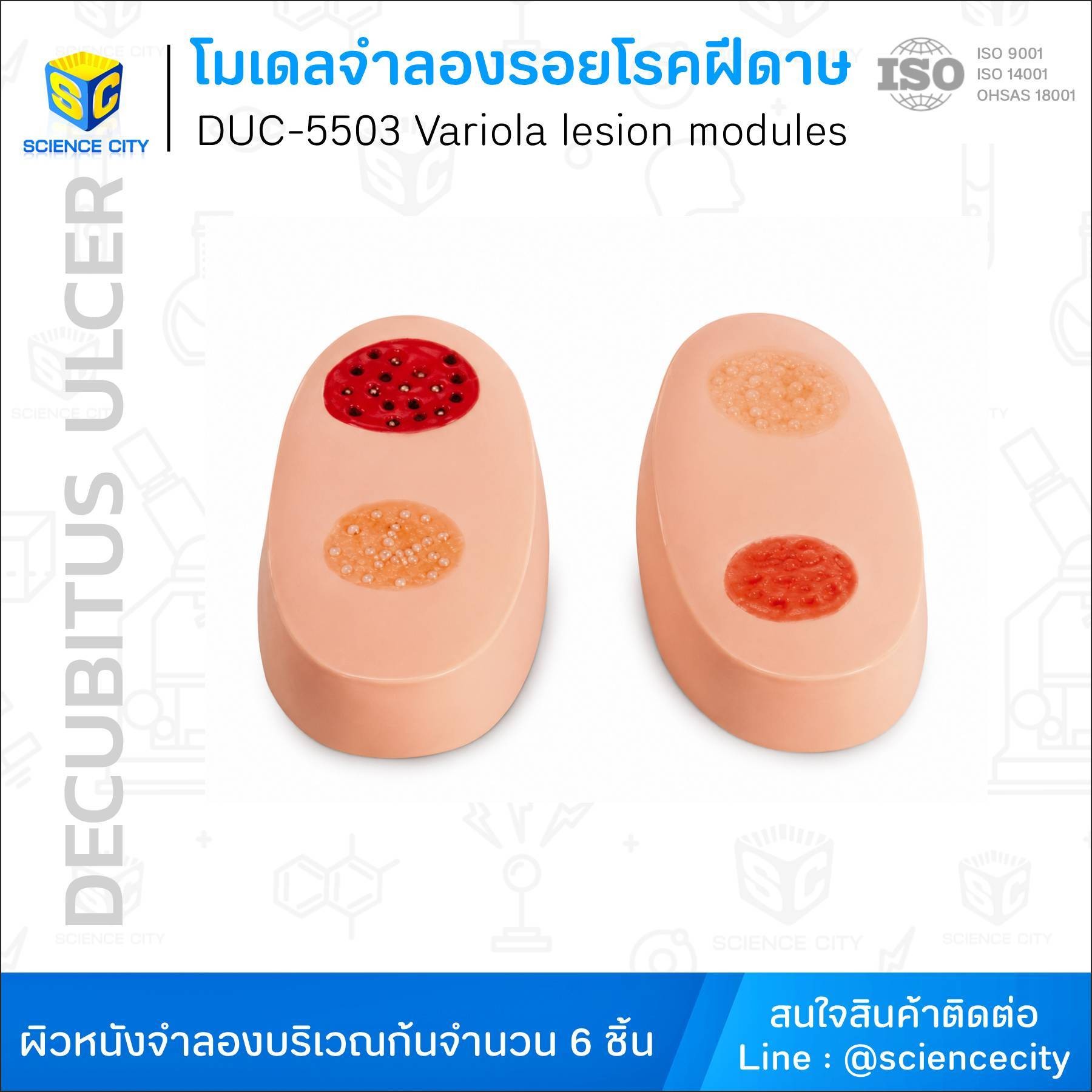 DUC-5503โมเดลจำลองรอยโรคฝีดาษWL