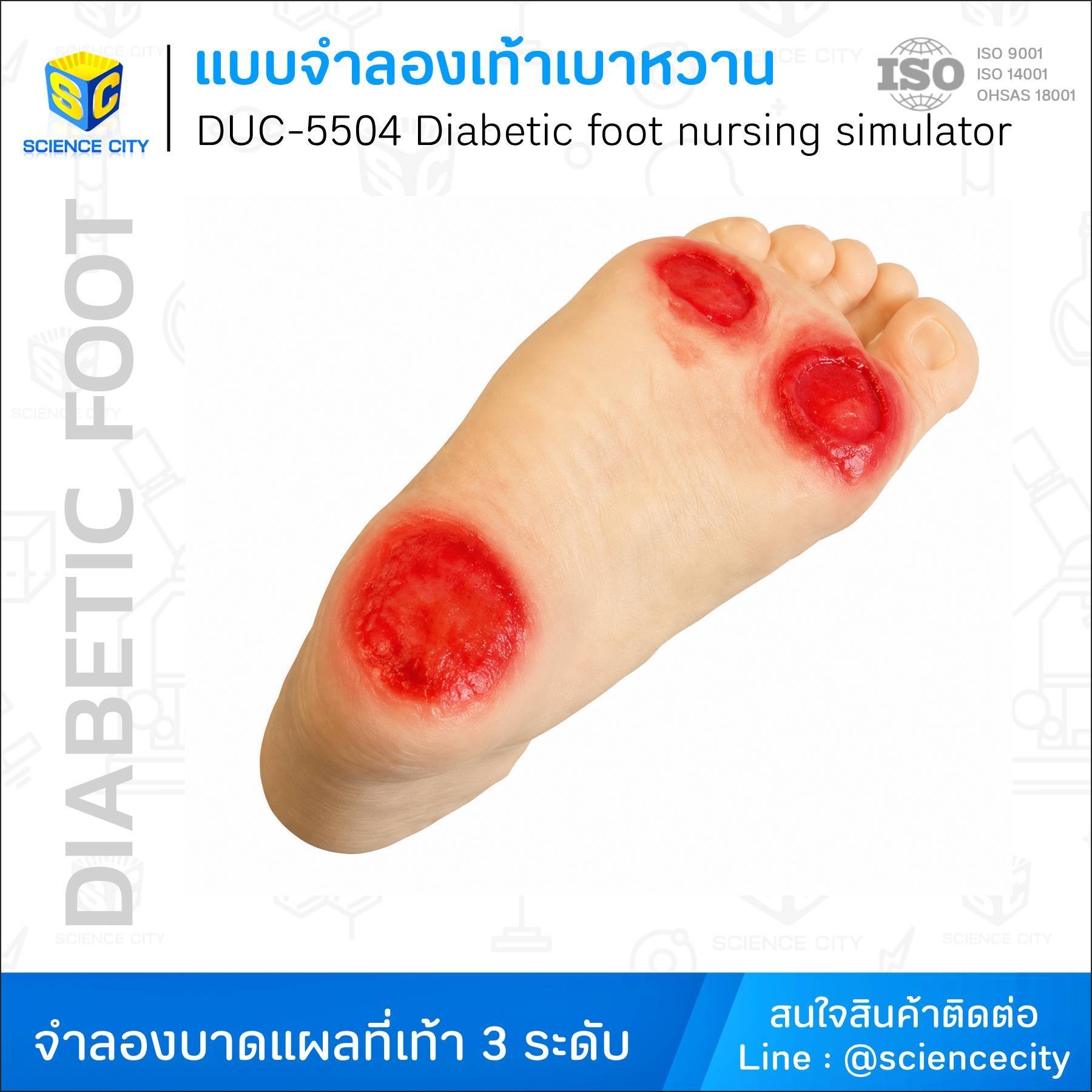 DUC-5504แบบจำลองเท้าเบาหวานWL