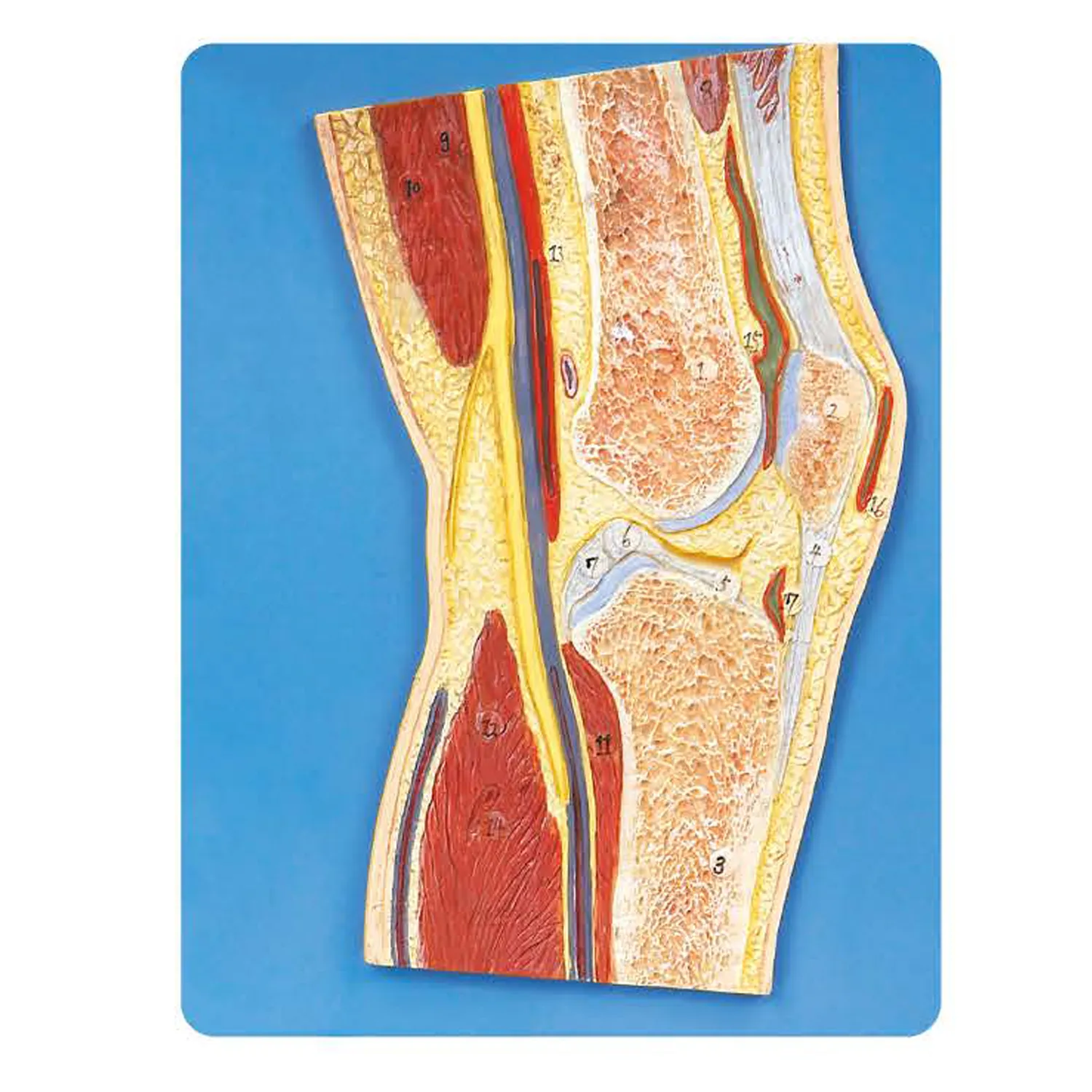 LEG-3306