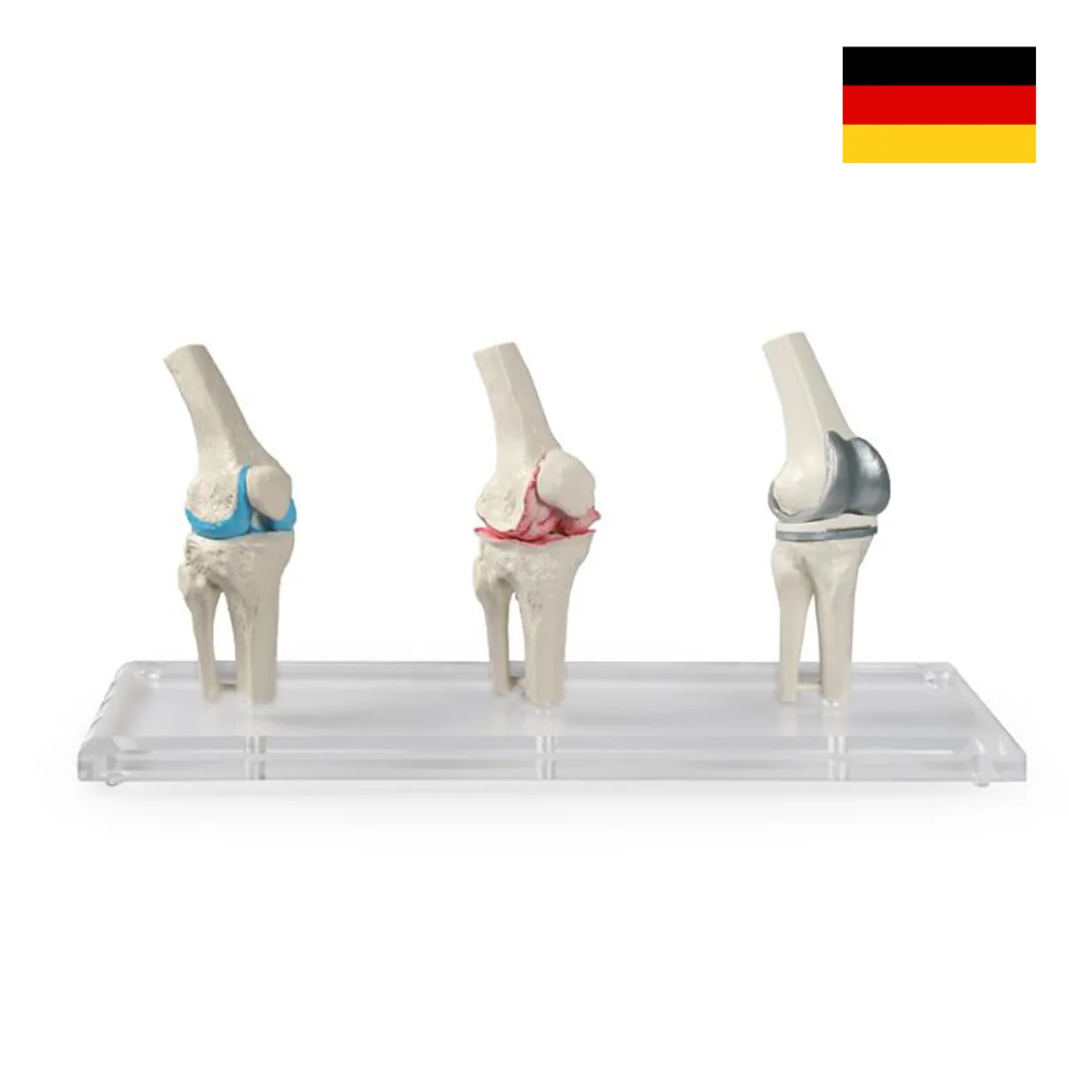 LEG-3308แบบจำลองข้อต่อหัวเข่าเปรียบเทียบ3แบบ(1)