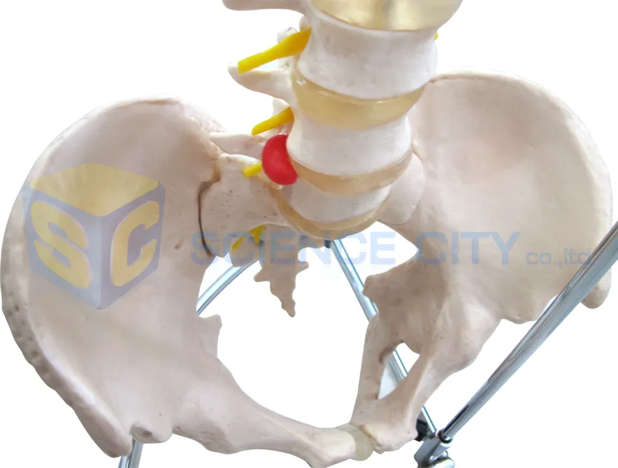 SPI-3501แบบจำลองกระดูกสันหลังและกระดูกสะโพก(1)
