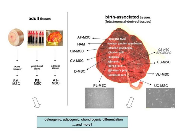 Allogeneic Mesenchymal Stem Cells