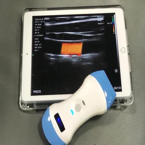 ultrasounddevice500x500