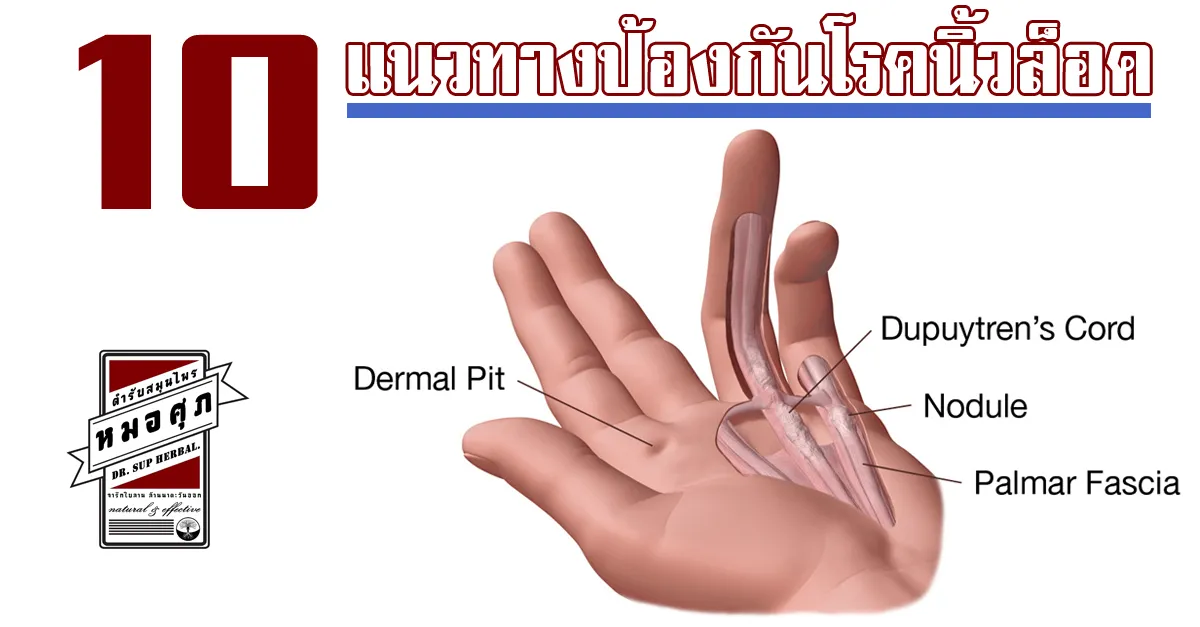 iTopPlus1232729581373