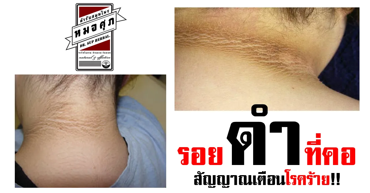 iTopPlus432997810086