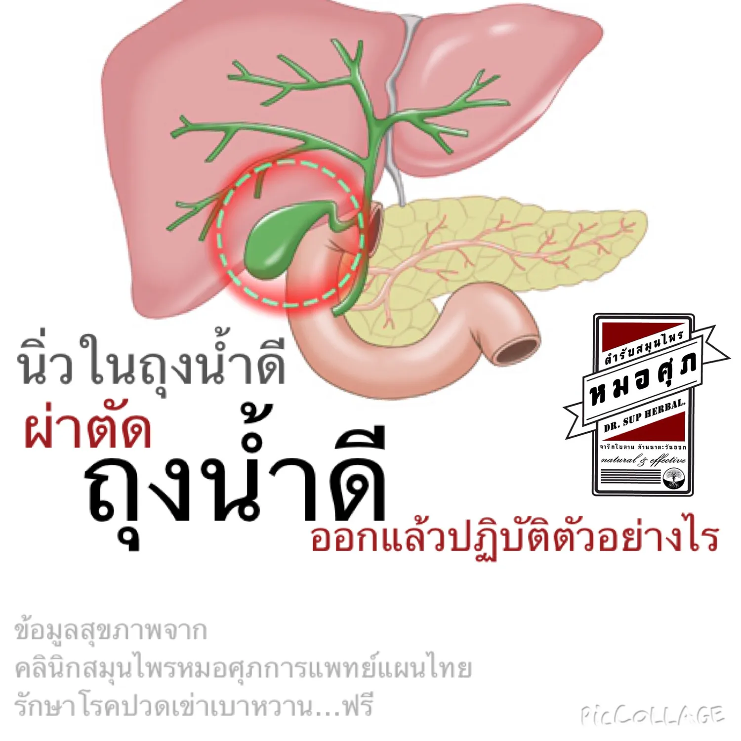 iTopPlus855644274846
