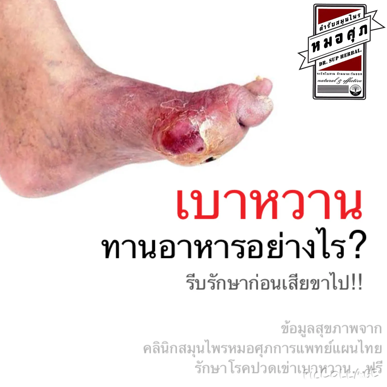 iTopPlus944421873379