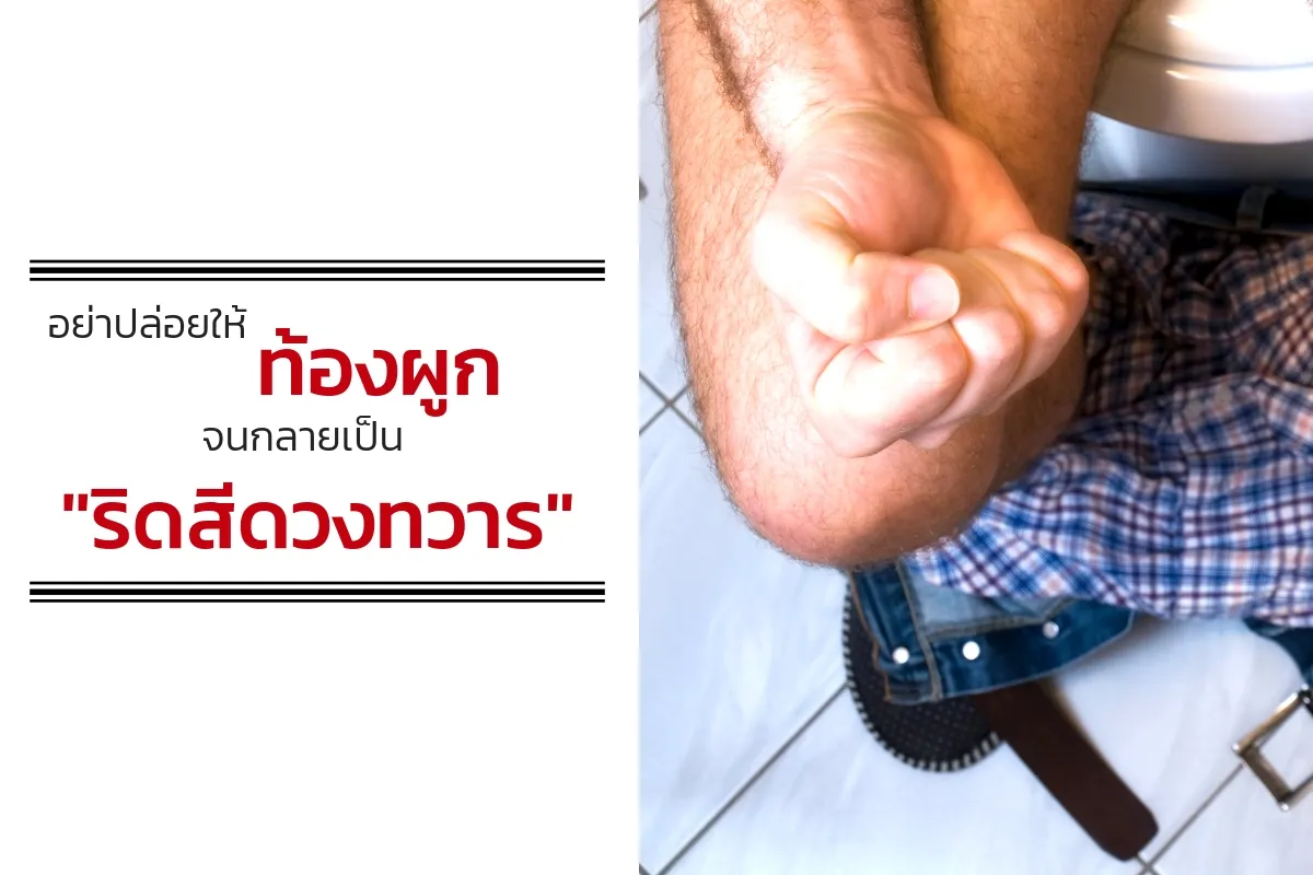 iTopPlus851382504427