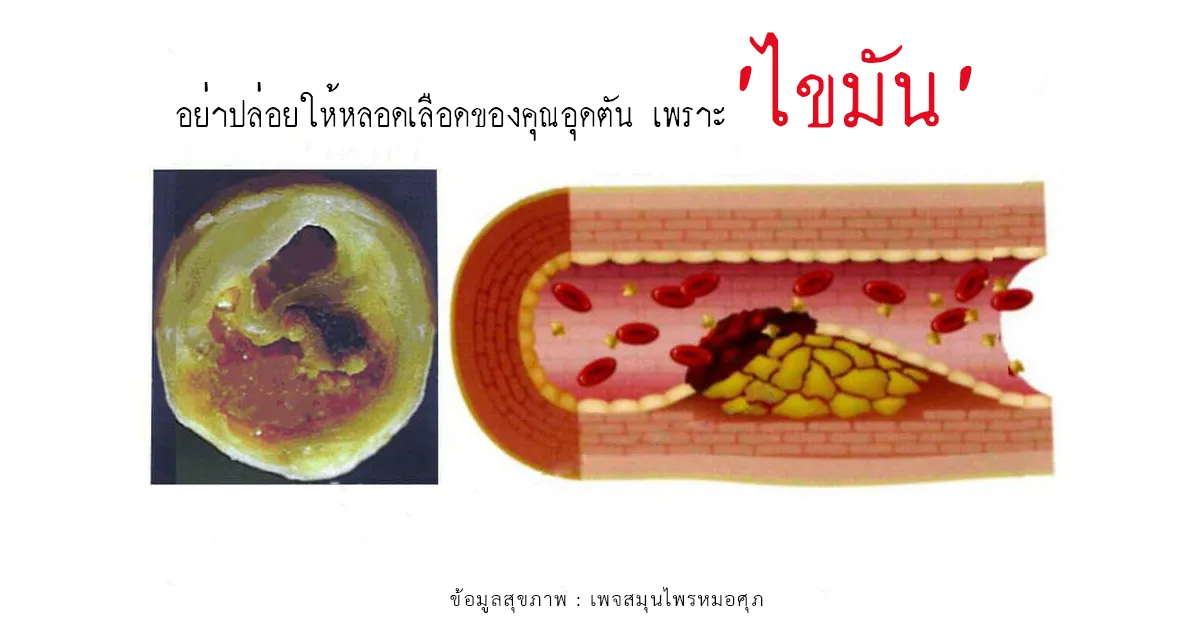 iTopPlus87315669447