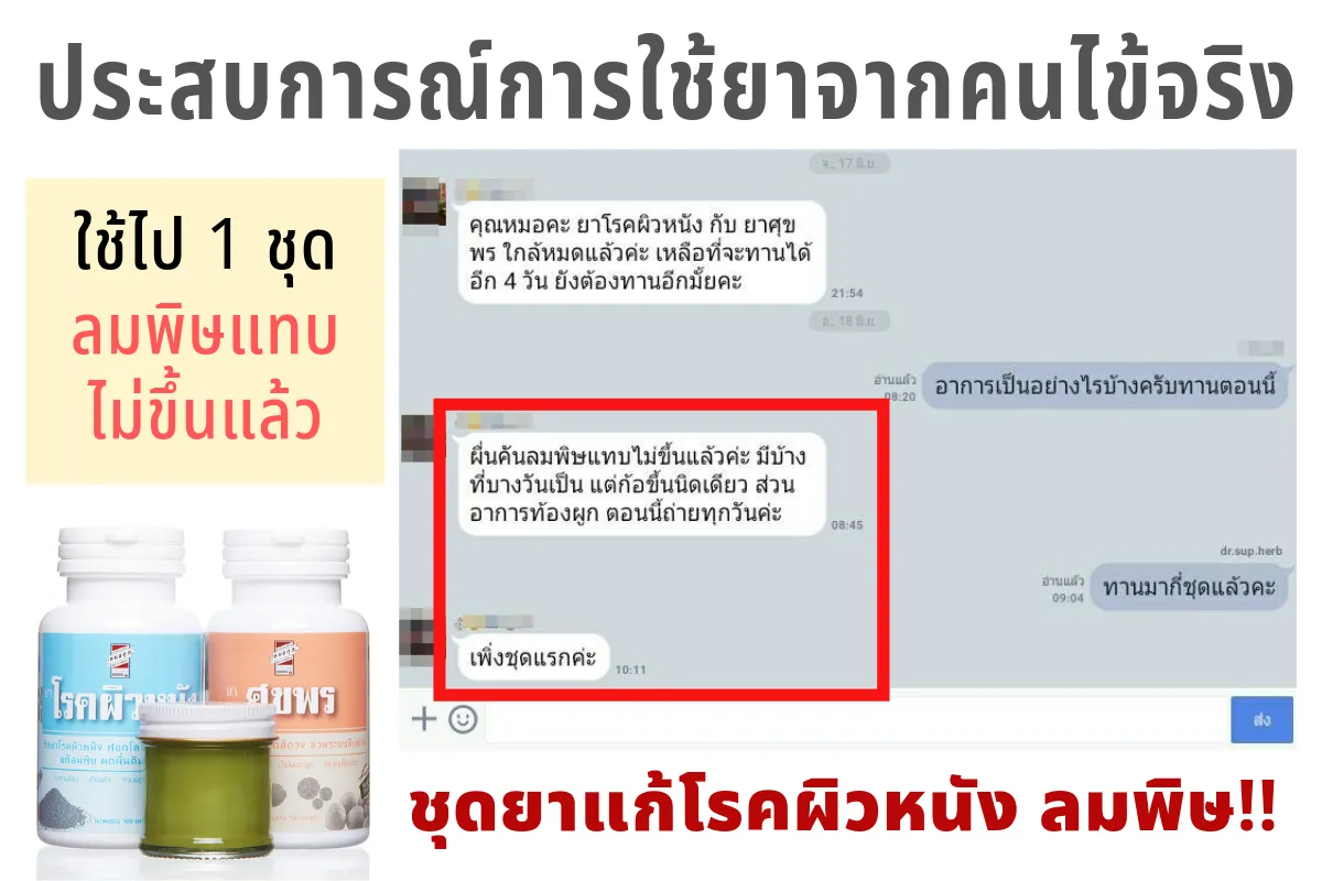 ผิว1