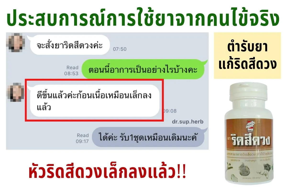 ริด1