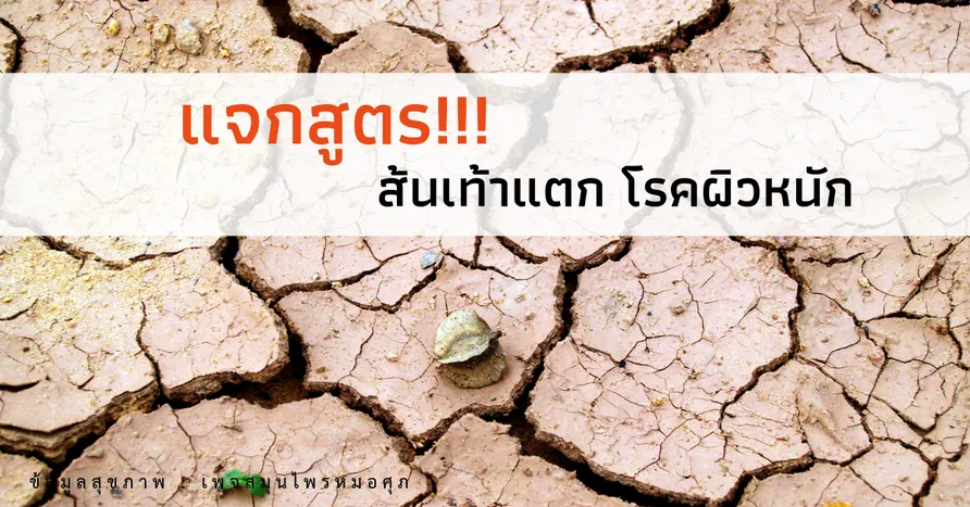 iTopPlus1014435037632