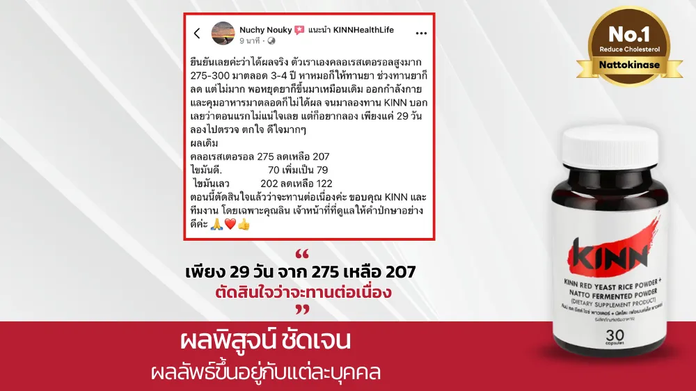 แม่แบบ(1)