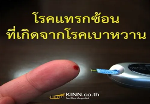 โรคแทรกซ้อนที่เกิดจากโรคเบาหวาน1