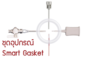 smartgasket