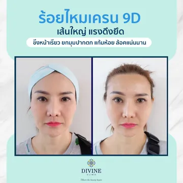 0315Divineclinic01