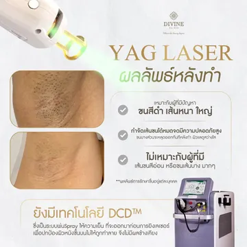 LINEALBUMโปรปี662408314