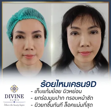 ส่งงานกราฟิกม
