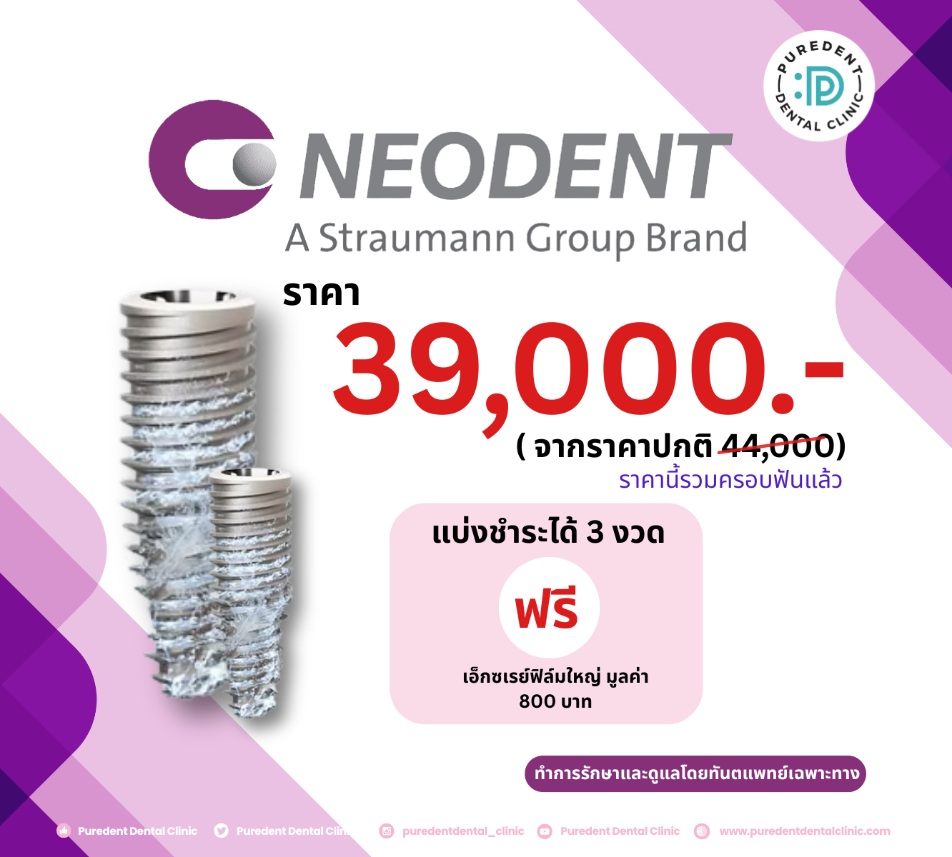 ImplantnewpricelineAO(1)