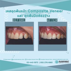 IMG-1346