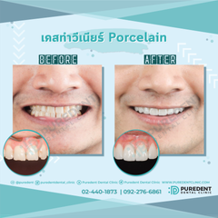 รีวิวคนไข้before-after2019แก้ฟอนต์(0011)-01