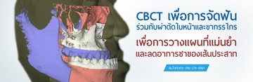 CBCT