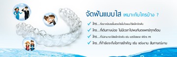 จัดฟันแบบใส