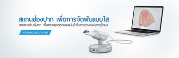 สแกนช่องปาก