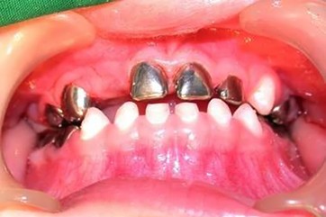 iTopPlus818216902741
