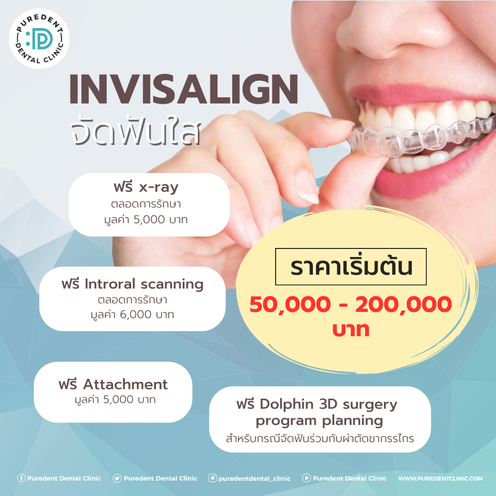 INVISALIGN(3)