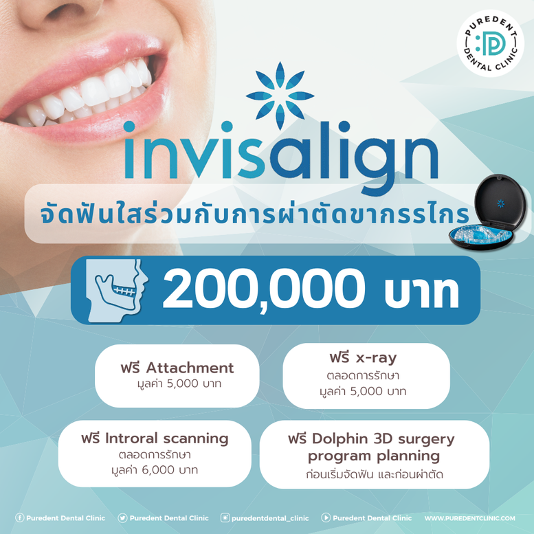 Invisalign