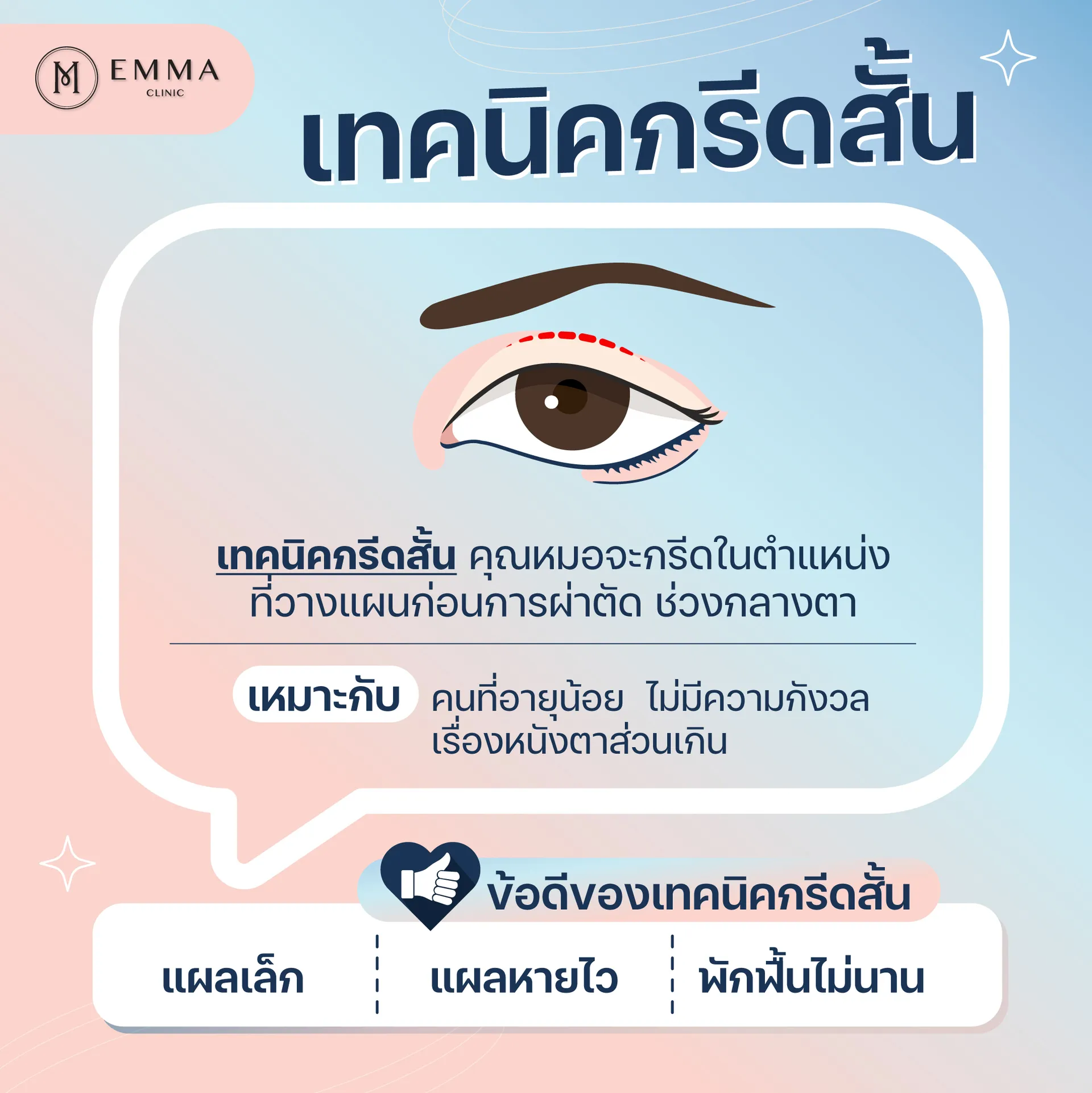 ไขข้อข้องใจตาสองชั้น เทคนิคกรีดสั้น vs เทคนิคกรีดยาว 2 กรีดตาสองชั้น-กรีดสั้น