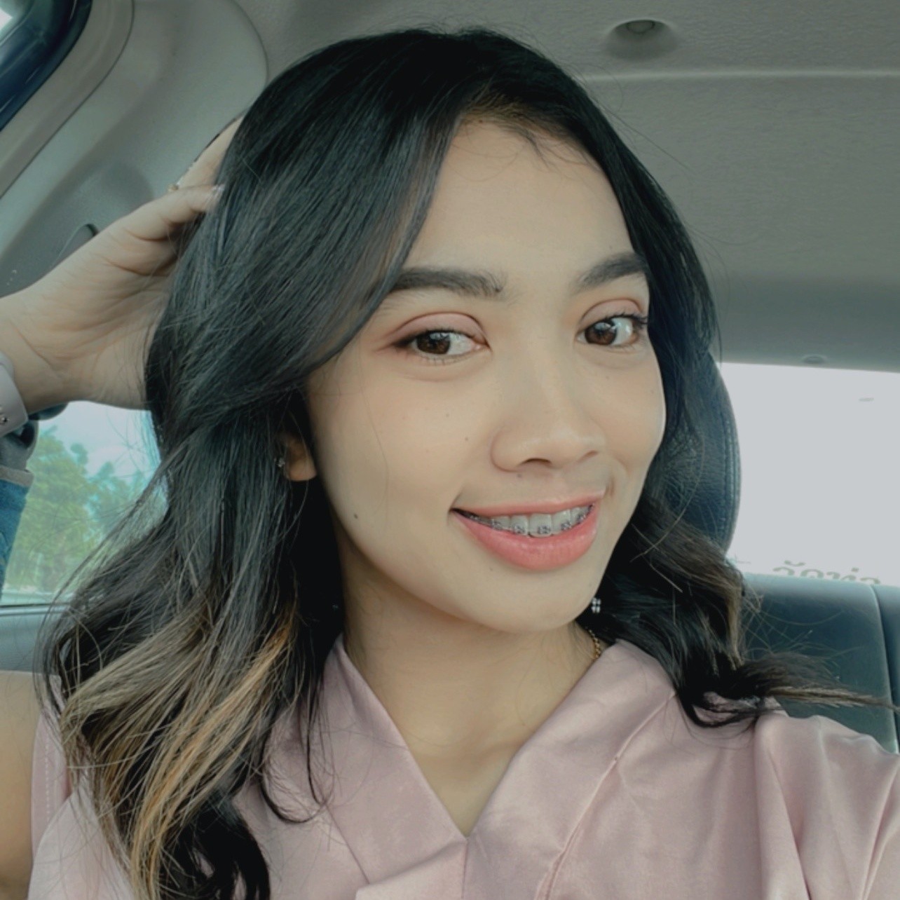 รีวิวเสริมจมูกแบบโอเพ่น ปรับโครงสร้าง ทรงสโลปสวยถูกใจ หน้าเปลี่ยนมาก 2 ก่อนเสริมจมูก