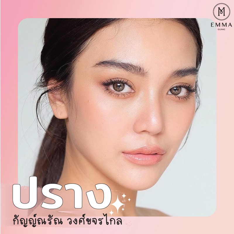 รวม 10 ดาราไอดอลไทย ที่คนไข้เอามาเป็นแบบเสริมจมูกเยอะที่สุด 11 %E0%B8%88%E0%B8%A1%E0%B8%B9%E0%B8%81%E0%B8%9B%E0%B8%A3%E0%B8%B2%E0%B8%87%E0%B9%81%E0%B8%9F%E0%B8%99%E0%B9%82%E0%B8%95%E0%B9%89z z1592204871038 EMMA CLINIC