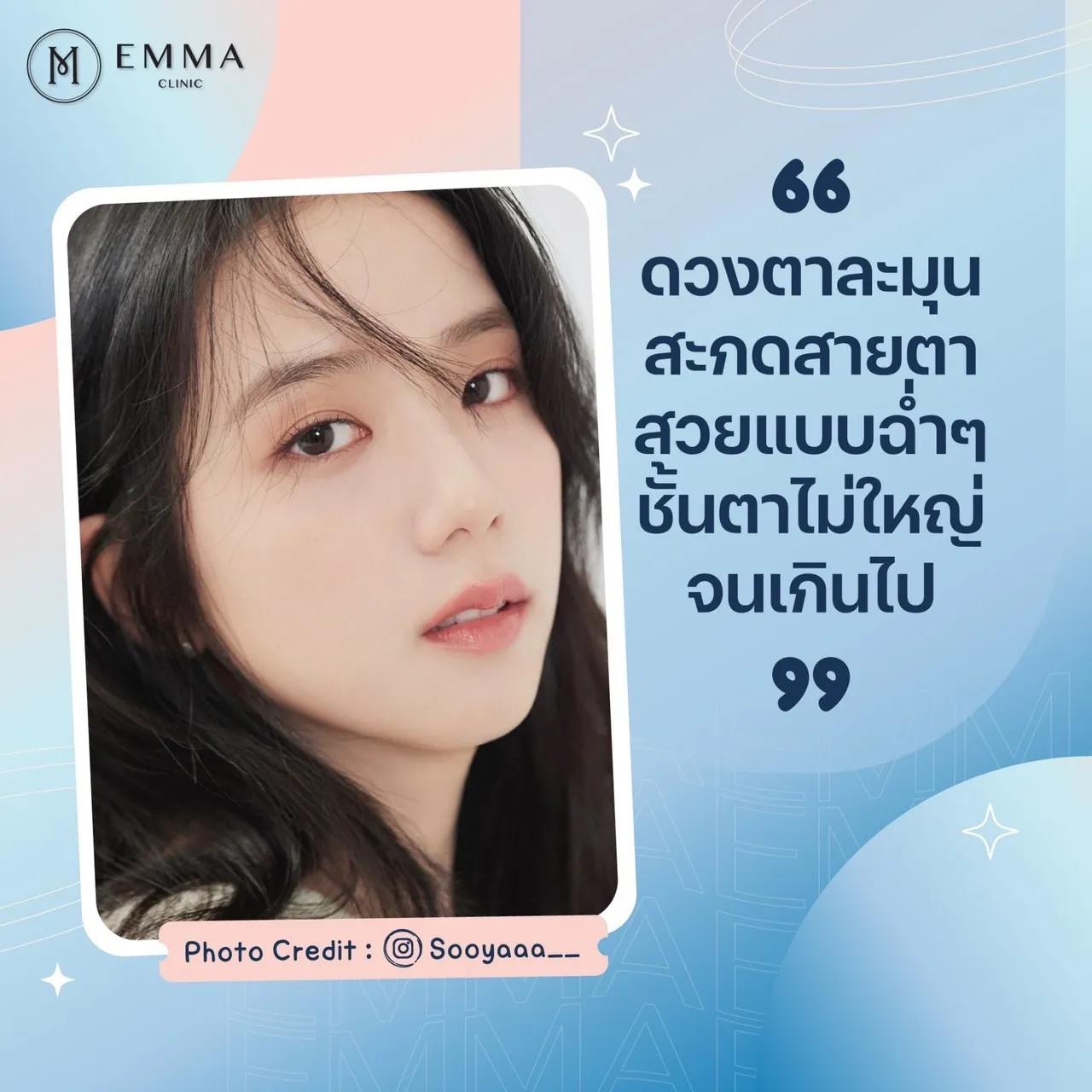 พาไปดู ทำตาสองชั้น Millieyes by Emma ชั้นตาแบบไหนที่เรียกว่า สไตล์เกาหลี 4 ทำตาสองชั้นสไตล์เกาหลี-millieyes