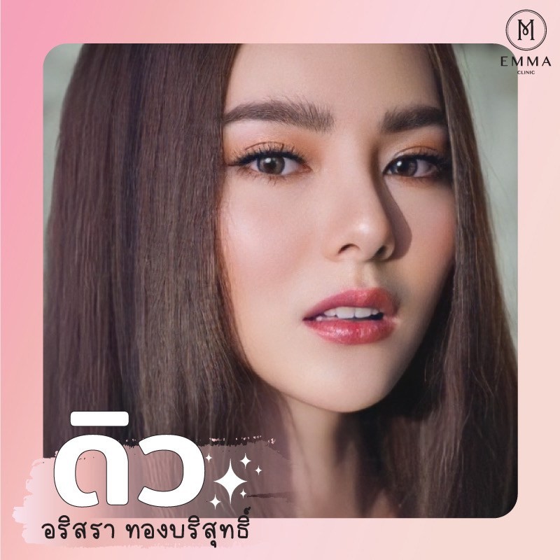 รวม 10 ดาราไอดอลไทย ที่คนไข้เอามาเป็นแบบเสริมจมูกเยอะที่สุด 7 %E0%B9%80%E0%B8%AA%E0%B8%A3%E0%B8%B4%E0%B8%A1%E0%B8%88%E0%B8%A1%E0%B8%B9%E0%B8%81%E0%B8%94%E0%B8%B2%E0%B8%A3%E0%B8%B2%E0%B9%84%E0%B8%97%E0%B8%A2%E0%B8%94%E0%B8%B4%E0%B8%A7z z379980849482 EMMA CLINIC