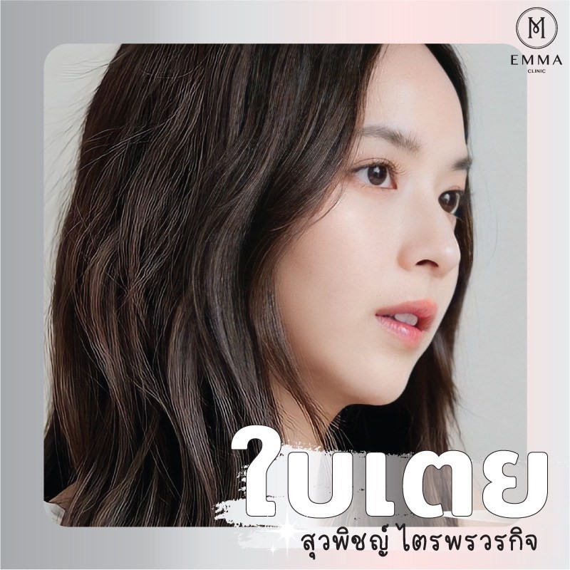 รวม 10 ดาราไอดอลไทย ที่คนไข้เอามาเป็นแบบเสริมจมูกเยอะที่สุด 9 %E0%B9%80%E0%B8%AA%E0%B8%A3%E0%B8%B4%E0%B8%A1%E0%B8%88%E0%B8%A1%E0%B8%B9%E0%B8%81%E0%B8%94%E0%B8%B2%E0%B9%84%E0%B8%97%E0%B8%A2%E0%B9%83%E0%B8%9A%E0%B9%80%E0%B8%95%E0%B8%A2z z1450401534950 EMMA CLINIC