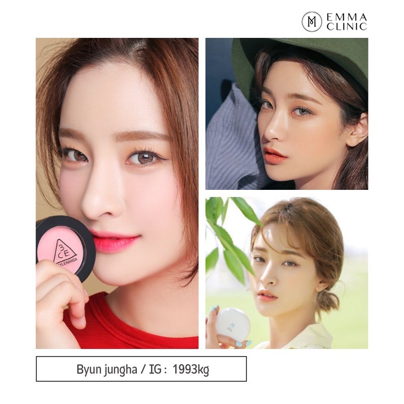 อัปเดตทรงจมูกสุดฮิต 2566 ทรงจมูก ที่ดารา ไอดอลเกาหลี เอามาเป็น Ref เสริมจมูกเยอะสุด 21 S1425583
