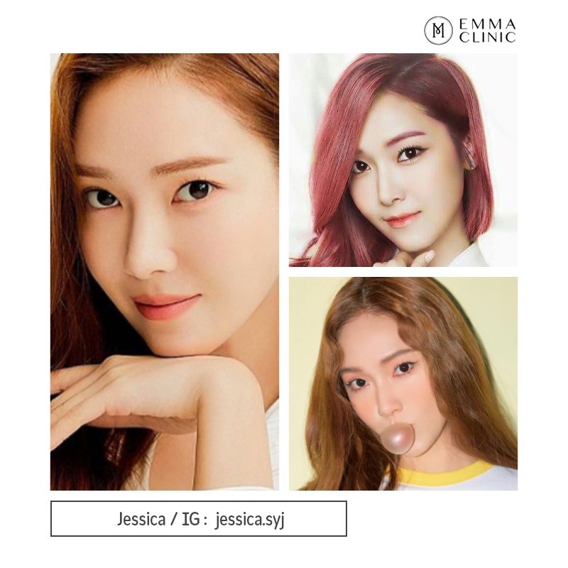 อัปเดตทรงจมูกสุดฮิต 2566 ทรงจมูก ที่ดารา ไอดอลเกาหลี เอามาเป็น Ref เสริมจมูกเยอะสุด 23 S1425585