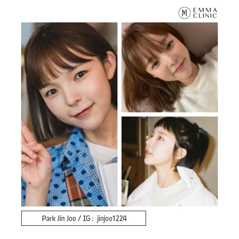 อัปเดตทรงจมูกสุดฮิต 2566 ทรงจมูก ที่ดารา ไอดอลเกาหลี เอามาเป็น Ref เสริมจมูกเยอะสุด 30 S1425589