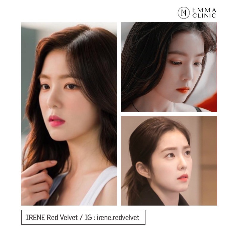 อัปเดตทรงจมูกสุดฮิต 2566 ทรงจมูก ที่ดารา ไอดอลเกาหลี เอามาเป็น Ref เสริมจมูกเยอะสุด 19 S1425590