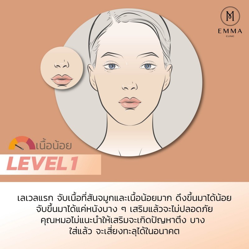 How to ดูเนื้อจมูก เสริมจมูกออกมาโด่งได้แค่ไหน? อ่านแล้วเข้าใจทำตามง่าย ๆ 9 level1z z1233094068105 EMMA CLINIC