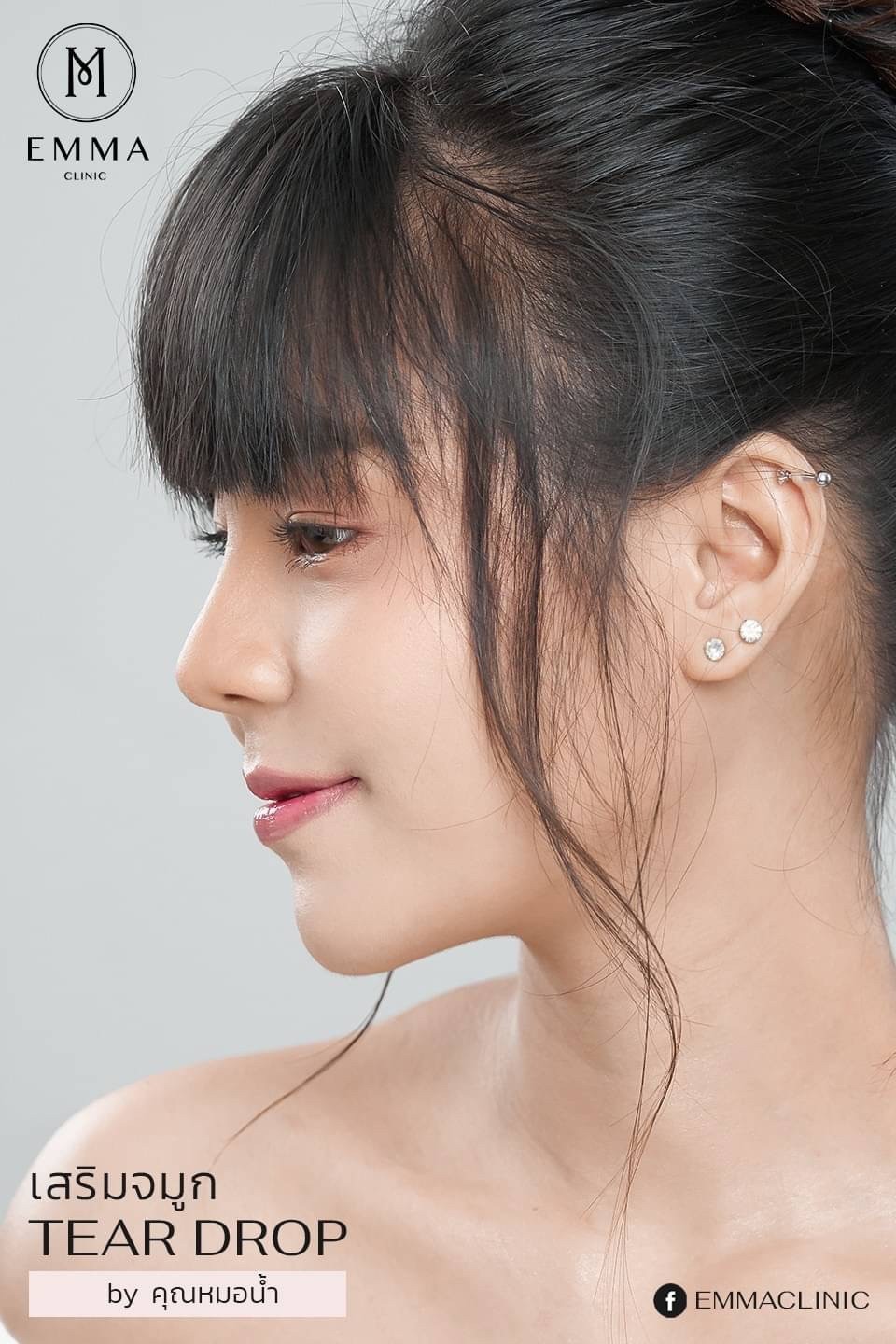 เสริมจมูกทรง Teardrop ทรงจมูกแห่งปี 2021 20 t7
