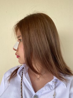 รีวิวเสริมจมูกโอเพ่น ปรับโครงสร้างจมูก เบี้ยว เอียง ด้วยเทคนิคยืดกระดูกปีกนก ให้ปลายพุ่งสุดจึ๊ง 8 เสริมจมูกโอเพ่น ดารา 1z z1539502254612 EMMA CLINIC