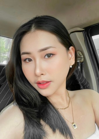 เสริมคางให้หน้าวีเชฟ แก้คางเหลี่ยม ปลายคางตัด สวยมีมิติแบบ 360 องศา 11 %E0%B8%A3%E0%B8%B5%E0%B8%A7%E0%B8%B4%E0%B8%A7%E0%B9%80%E0%B8%AA%E0%B8%A3%E0%B8%B4%E0%B8%A1%E0%B8%84%E0%B8%B2%E0%B8%87 MCz z859547678352 เสริมคาง EMMA CLINIC