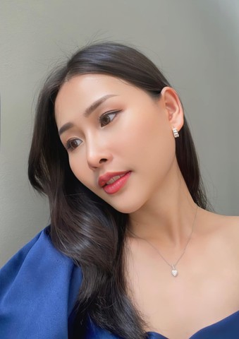 เสริมคางให้หน้าวีเชฟ แก้คางเหลี่ยม ปลายคางตัด สวยมีมิติแบบ 360 องศา 12 %E0%B9%80%E0%B8%AA%E0%B8%A3%E0%B8%B4%E0%B8%A1%E0%B8%84%E0%B8%B2%E0%B8%87 MC %E0%B9%80%E0%B8%81%E0%B8%B2%E0%B8%AB%E0%B8%A5%E0%B8%B5z z562305291520 เสริมคาง EMMA CLINIC