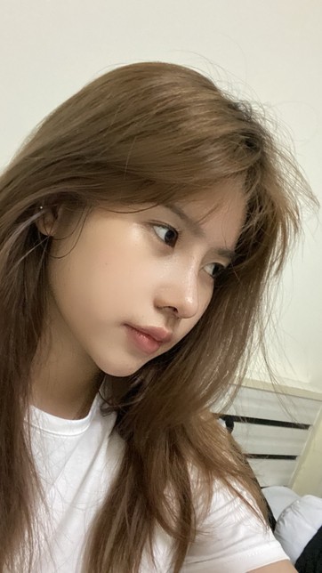 รีวิวเสริมจมูกโอเพ่น ปรับโครงสร้างจมูก เบี้ยว เอียง ด้วยเทคนิคยืดกระดูกปีกนก ให้ปลายพุ่งสุดจึ๊ง 13 เสริมจมูก ดารา 1z z377343212825 EMMA CLINIC