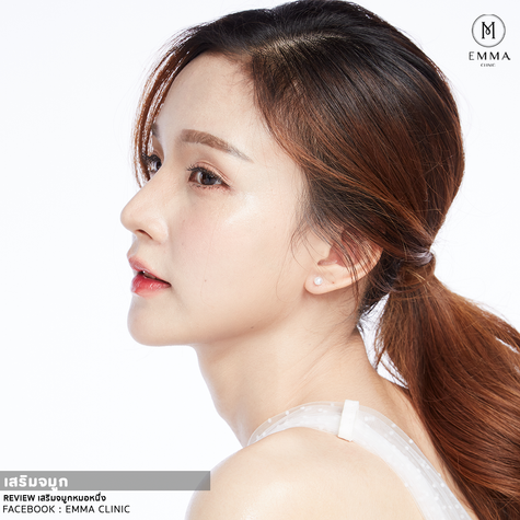 เรฟจมูกหยดทรงน้ำ 7 ไอดอลเกาหลีหน้าสวย เซฟด่วน | EMMA Clinic 13 196z z740437328597