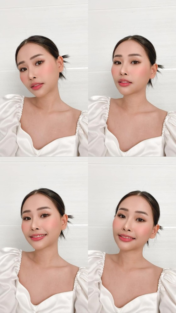 เสริมคางให้หน้าวีเชฟ แก้คางเหลี่ยม ปลายคางตัด สวยมีมิติแบบ 360 องศา 7 %E0%B8%AB%E0%B8%A5%E0%B8%B1%E0%B8%87%E0%B9%80%E0%B8%AA%E0%B8%A3%E0%B8%B4%E0%B8%A1%E0%B8%84%E0%B8%B2%E0%B8%87%E0%B8%AA%E0%B8%A7%E0%B8%A2 %E0%B8%98%E0%B8%A3%E0%B8%A3%E0%B8%A1%E0%B8%8A%E0%B8%B2%E0%B8%95%E0%B8%B4z z93961656843 เสริมคาง EMMA CLINIC