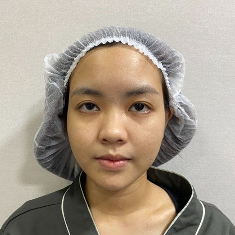 รวมรีวิวเสริมจมูกเนื้อน้อย คัดมาแบบปัง ๆ 10 เคส | EMMA Clinic 17 Before%E0%B8%99%E0%B9%89%E0%B8%AD%E0%B8%87%E0%B8%95%E0%B8%B8%E0%B9%8A%E0%B8%81%E0%B8%95%E0%B8%B2%E0%B9%82%E0%B8%94%E0%B8%A2%E0%B8%84%E0%B8%B8%E0%B8%93%E0%B8%AB%E0%B8%A1%E0%B8%AD%E0%B8%9A%E0%B8%B4%E0%B9%8A%E0%B8%81z z1259357140274